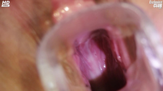 Врач-гинеколог смотрит пещерку наивной Юльки